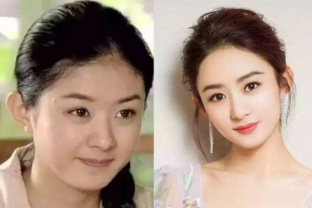 原创赵丽颖产后脱发?《有翡》《楚乔传》造型对比发际线高低一目了然