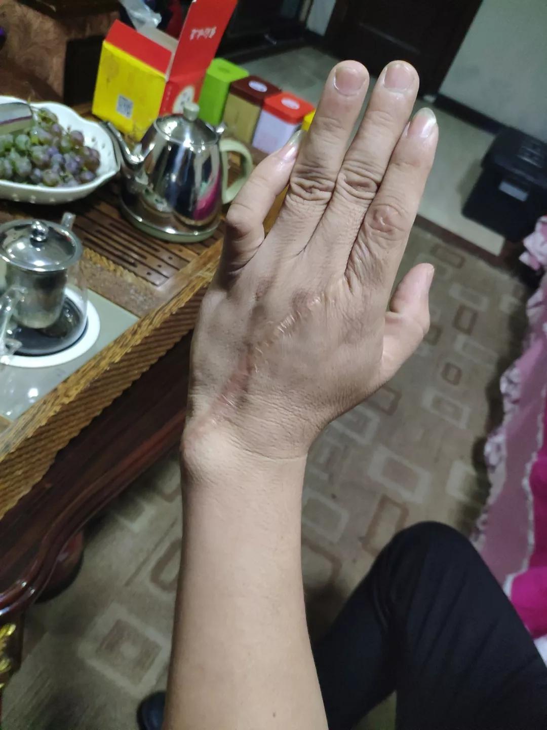 扫黑除恶下"砍刀队"仍不收手:谁在给它"壮胆"?