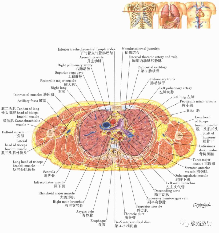 解剖丨縱隔食管胸部斷面