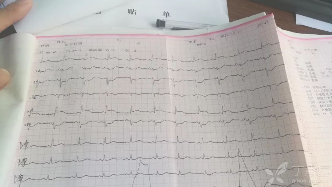 胸痛25小時入院病情好轉後卻突然死亡