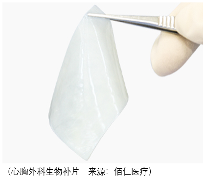 那么在后续的发展中,神经外科生物补片很难对佰仁医疗有多大的正面