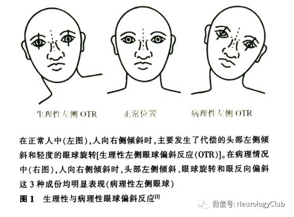 代偿头位测定图片