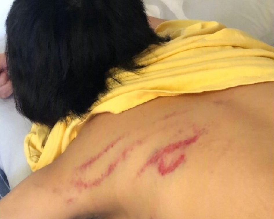 张珂玄细数张嫮目七宗罪:"单方面使用暴力数次","严峻侵略隐私权","