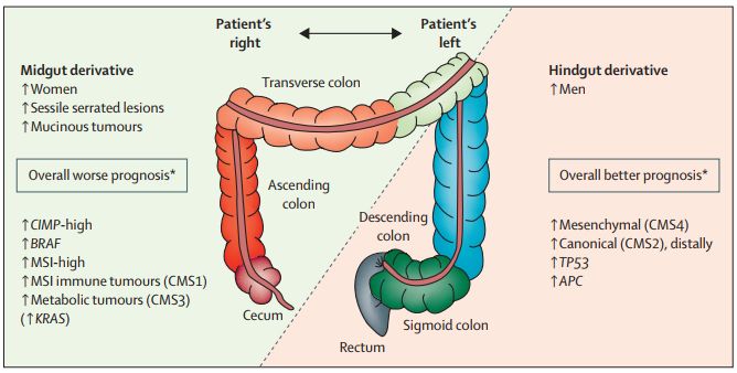左伴和右伴結直腸癌01圖1 結直腸癌的發展形成機