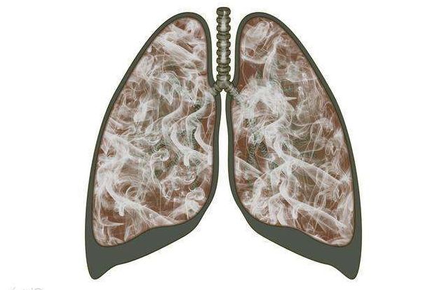 占职业病总数90%的尘肺病,到底有多可怕?