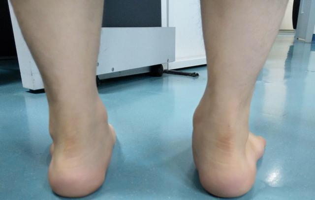 为什么nba球星患了扁平足,打球还是这么牛?他们的秘密在这_运动