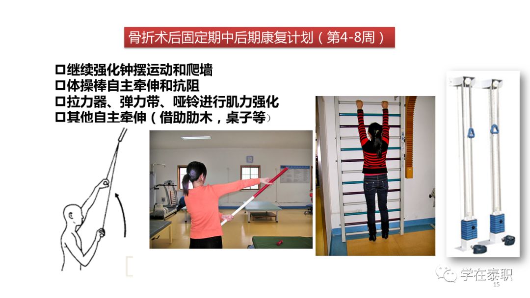 【康复方案】锁骨骨折的术后康复,附全套训练计划