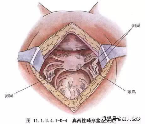 双性人真的存在吗有什么办法避免吗专家终于说出真相