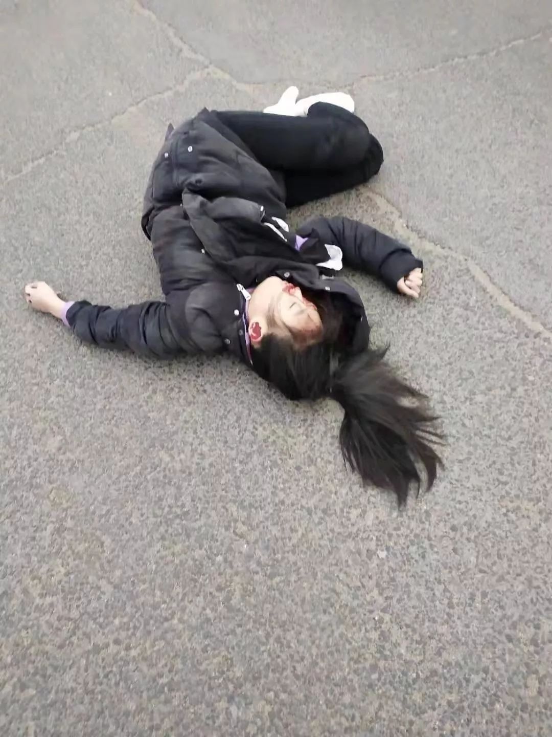 张北两名小女孩出车祸,生命垂危!