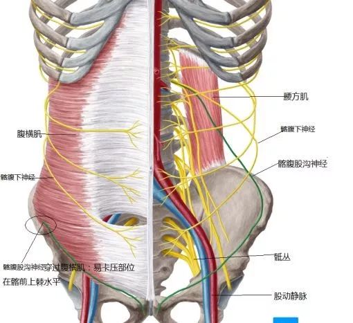 髂腹下神经自腰大肌上部外侧缘穿出,经过腹横肌与腹内斜肌之间,分为前