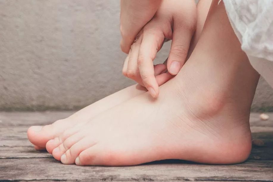 这个部位一到冬天就干裂起皮女生都会忽略的死角你注意到了吗