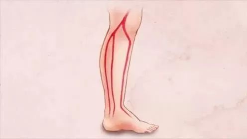 脚还可以导致毛细血管破裂,形成皮肤上的出血点,如果静脉血栓病人正在