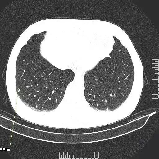 友谊医院预约专家CT加急-北京友谊医院做ct预约多久 