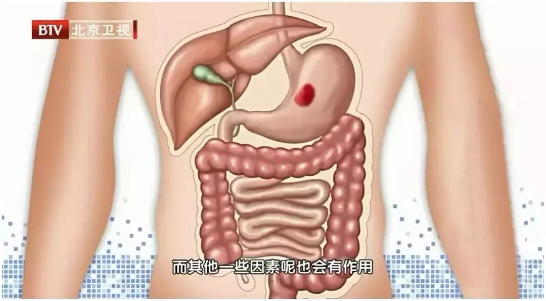 每天这个时间排便的人可能更长寿3步调理摆脱便秘腹泻老毛病