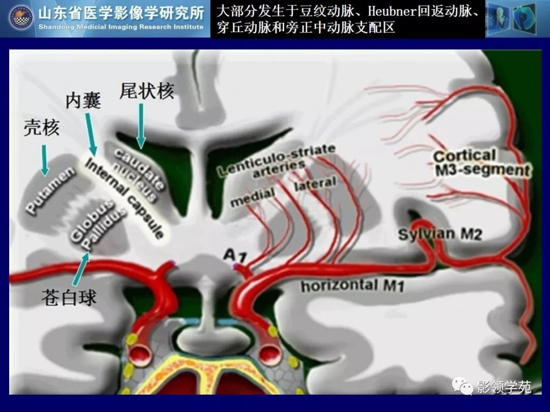 回返性抑制图片