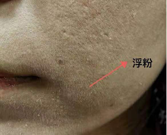 主要表现为脸部有一种粗糙的颗粒感,粉体挂在了皮肤的绒毛上,妆感特别