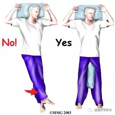 围手术期宣教骨科常见手术术后体位