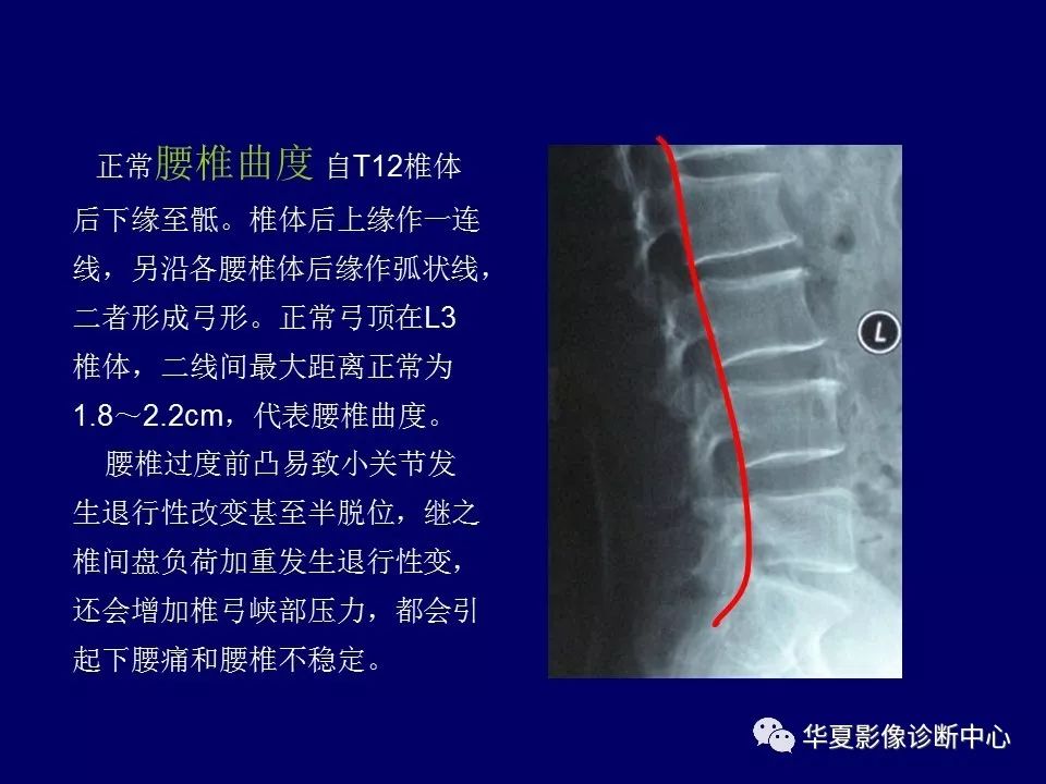 影像重温丨腰椎结核的ct诊断与鉴别诊断