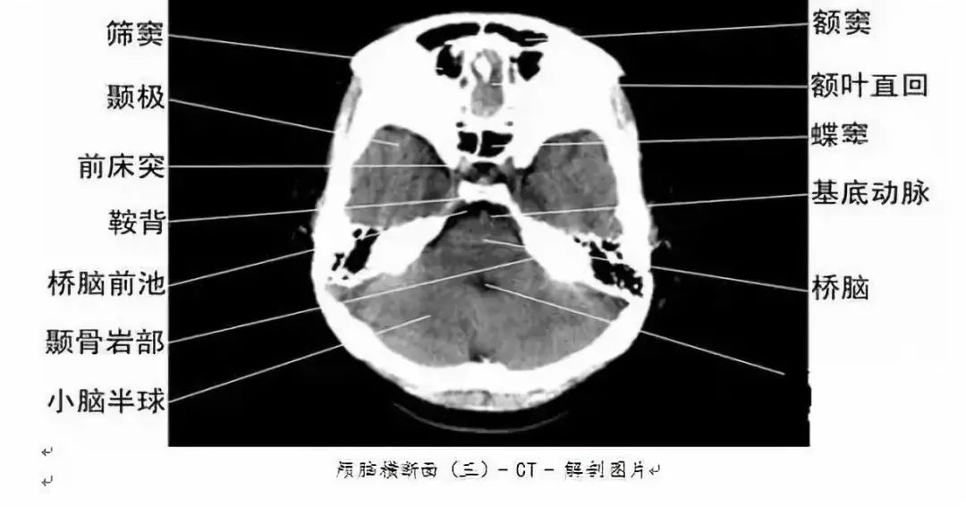 全身ct图谱赶紧收藏了吧