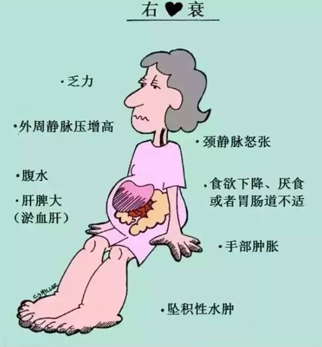 关于心力衰竭,你需要知道这些