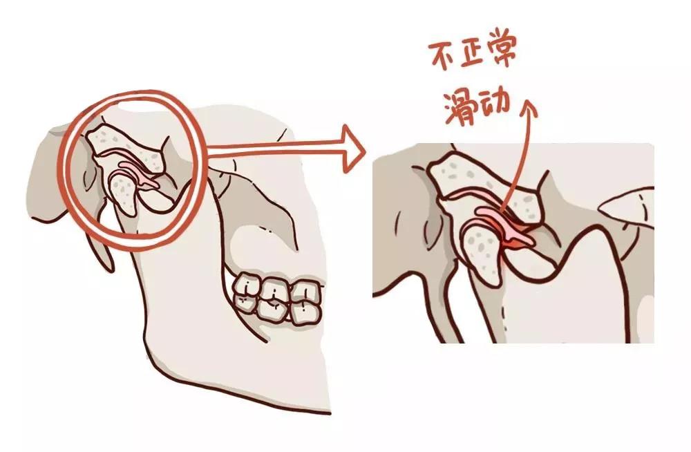 正常髁突图片