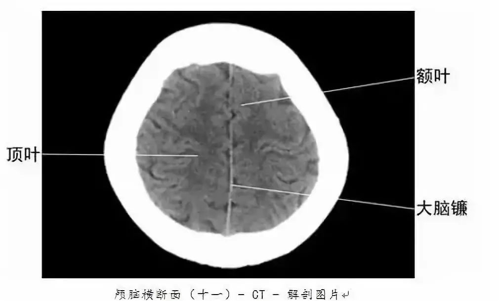 全身ct图谱赶紧收藏了吧