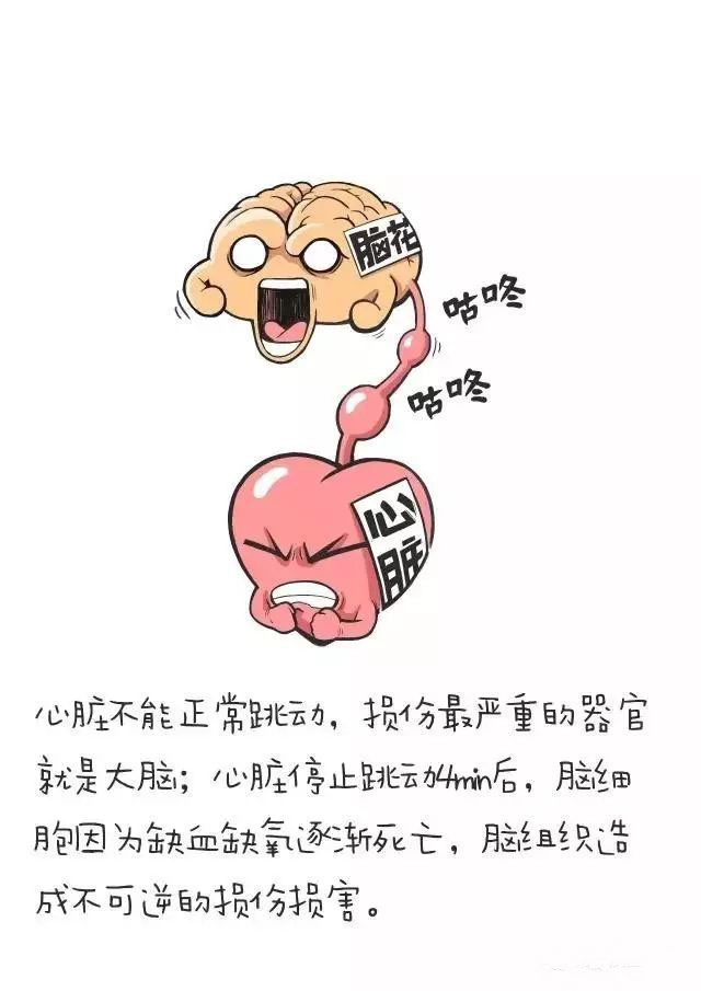 扩散心脏骤停正确抢救