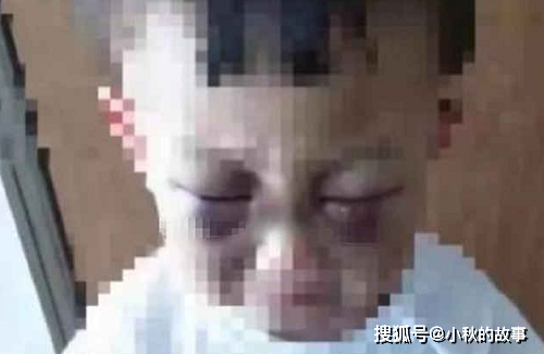 原创三岁惨遭继母虐待,亲生父亲表示不知情,网友:眼睛瞎了吗