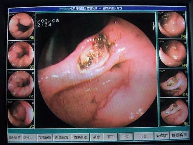 喝酒后出现这4个症状是胃在求救