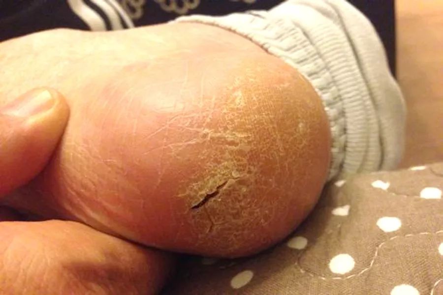 此症除外部因素和生理性衰老所致外,从中医角度讲,多是因为气血亏虚或