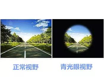 日签| 爱看电子产品的朋友们,一定要关注眼压!