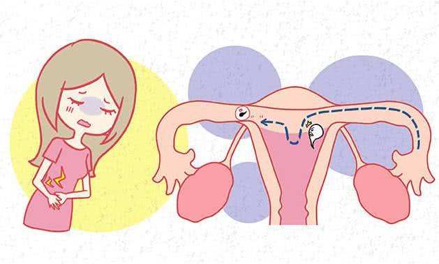 试管婴儿胚胎着床的征兆,有这几点好孕将近!