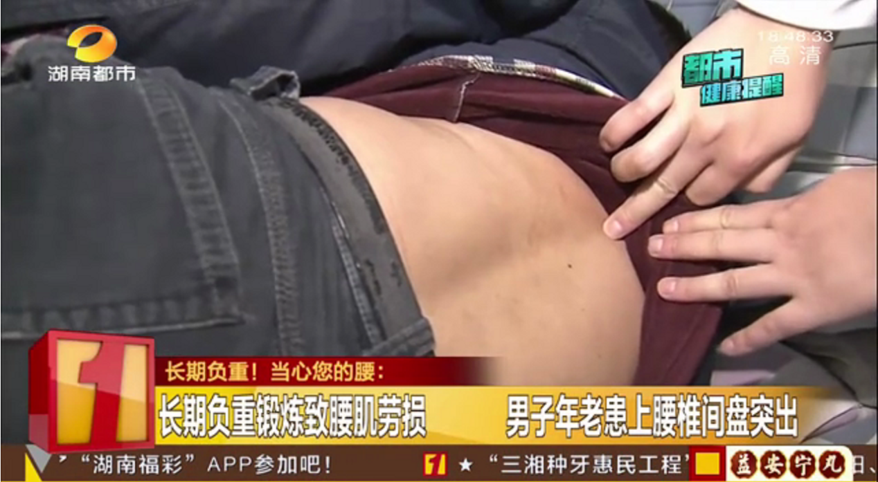 长期负重锻炼致腰肌劳损,男子年老患上腰椎间盘突出