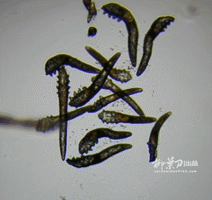 治疗方法层出不穷及眼部物理治疗,强脉冲光治疗等干眼检查眼表分析仪