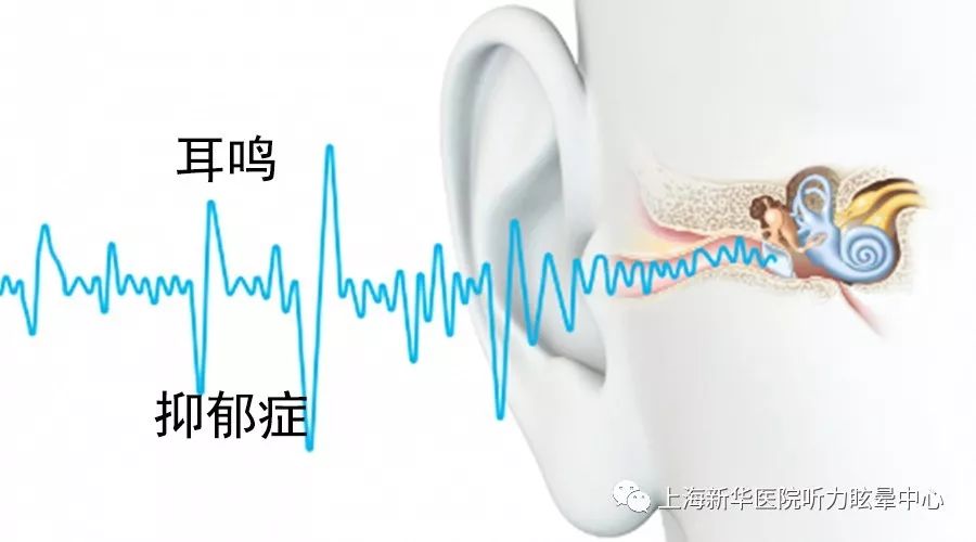 抑郁症会耳鸣吗 来自搜狐网