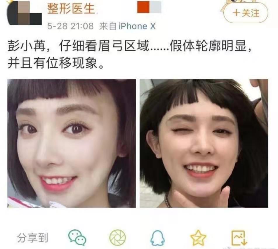 东宫女主整容前照片图片