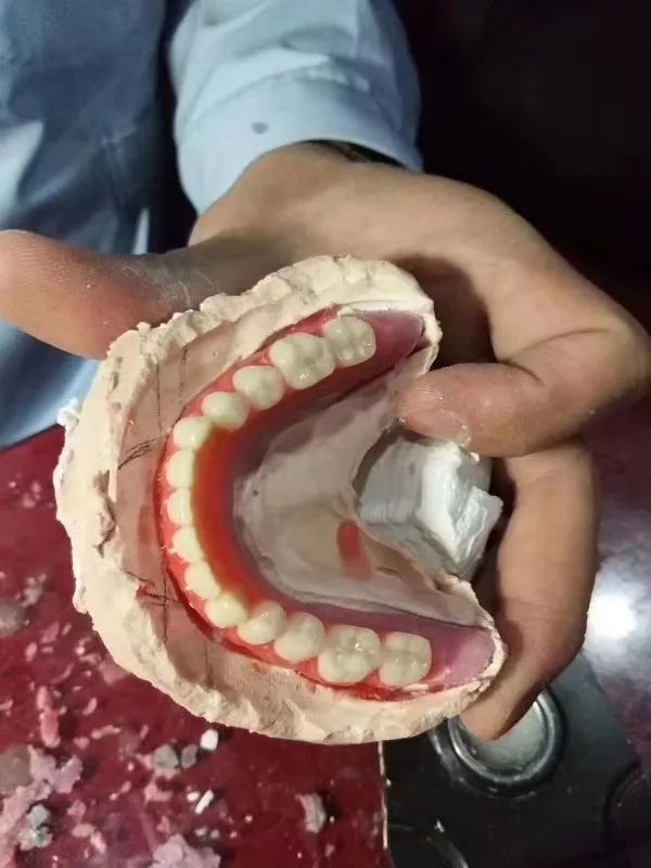 贺:德派【倍适雅舒适性全口义齿】理论 实操培训——郑州站圆满成功!