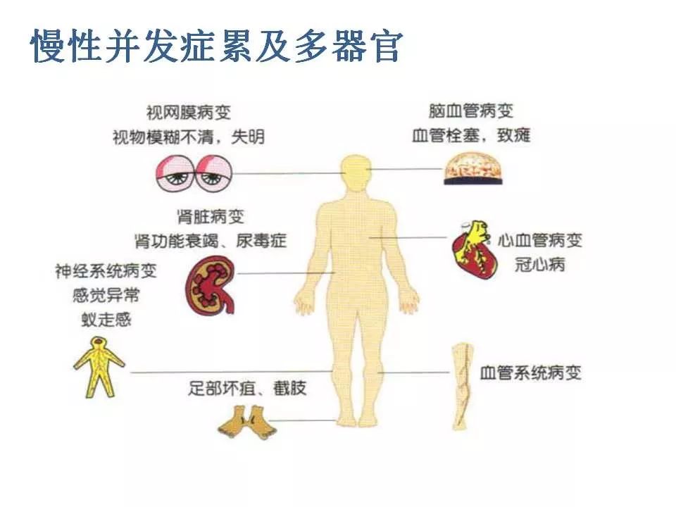 新時代文明實踐 | 防控糖尿病併發症 保護我們的未來