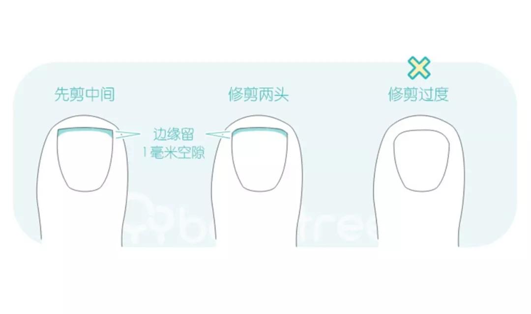 戴小手套可以吗?不可以_剪指甲