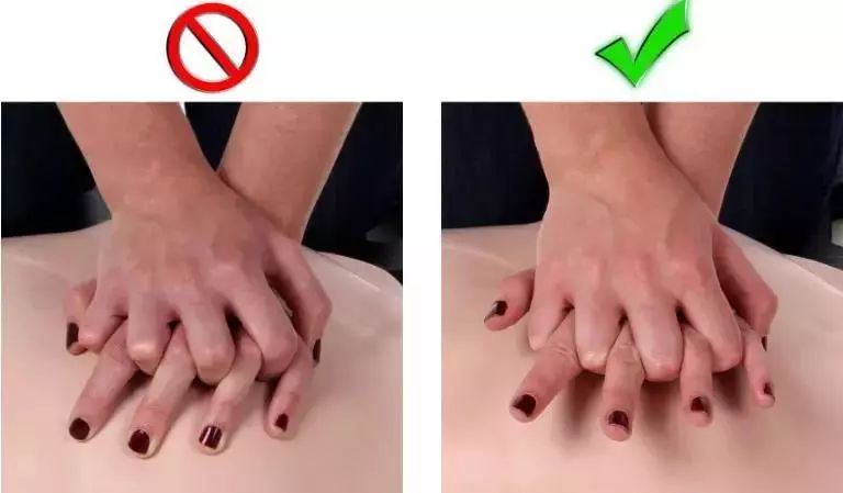 如果有人突然倒地你敢上前施救吗心肺复苏视频图文分解步骤学起来