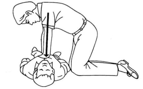 遇到紧急情况时给女性做心肺复苏到底要不要解开内衣