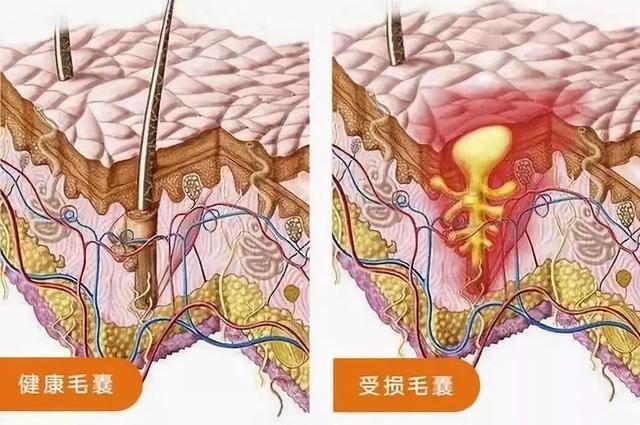 看看少掉髮的小妙招_頭皮