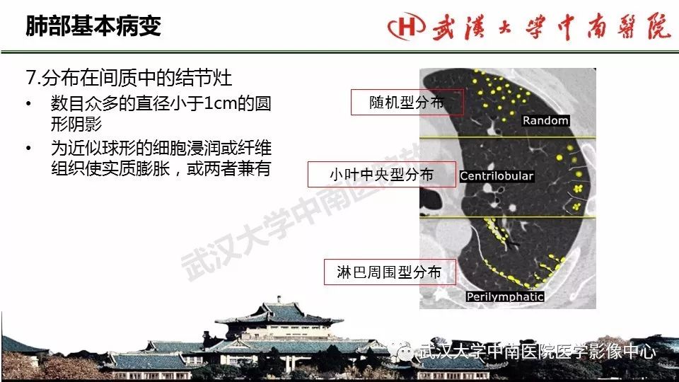 肺部影像解剖及基本概念基本病变