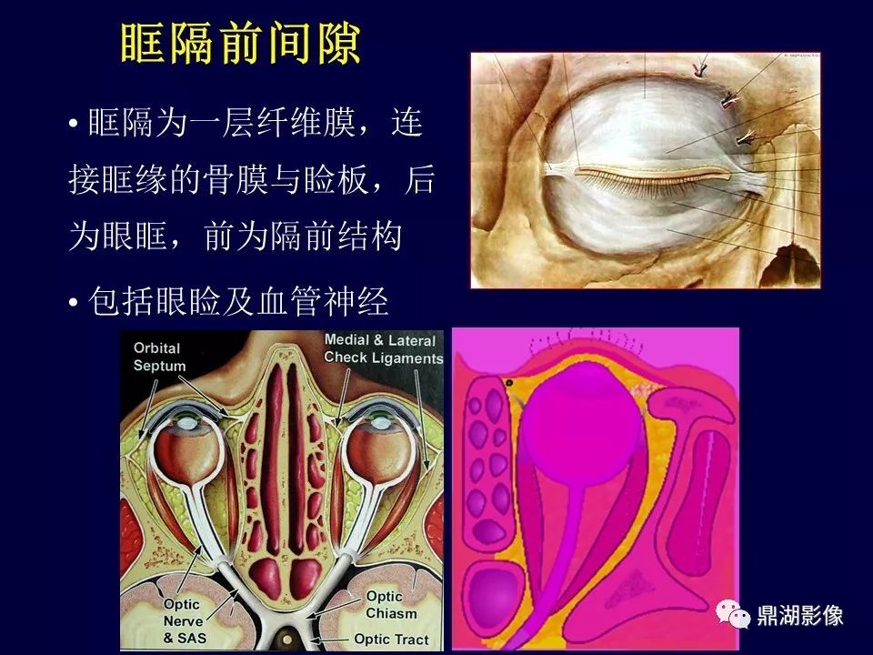 王振常眼部解剖基礎與影像學定位診斷