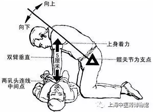 开放气道使病人去枕后仰于地面或硬板床上,解开衣领及裤带