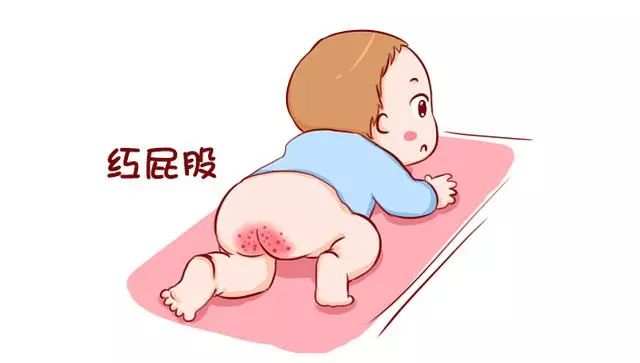 宝宝反复红屁股对付它很简单