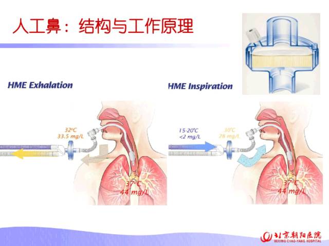 ppt朝陽醫院老師教你學會人工氣道溼化療法