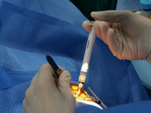 三连注射葡萄膜炎新药yutiq在海南博鳌超级医院拿下帽子戏法