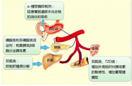 胰島素:不僅用於1型糖尿病