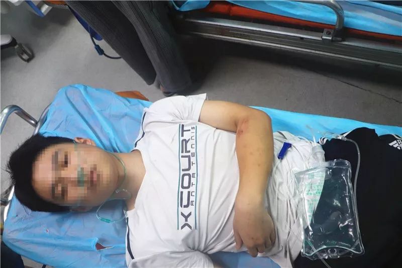 西充一货车与超标电动车相撞幸好